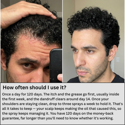 Alphainfuse™ Ultimate Scalp Recovery Spray