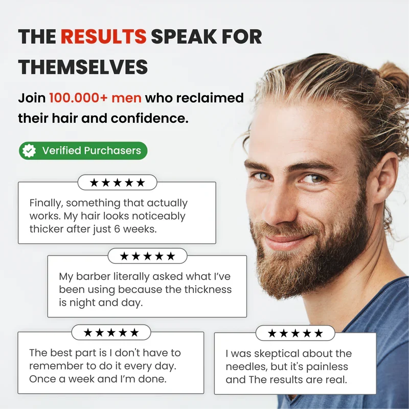 Alphainfuse™ Hair Growth System
