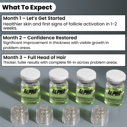 Alphainfuse™ Hair Growth System
