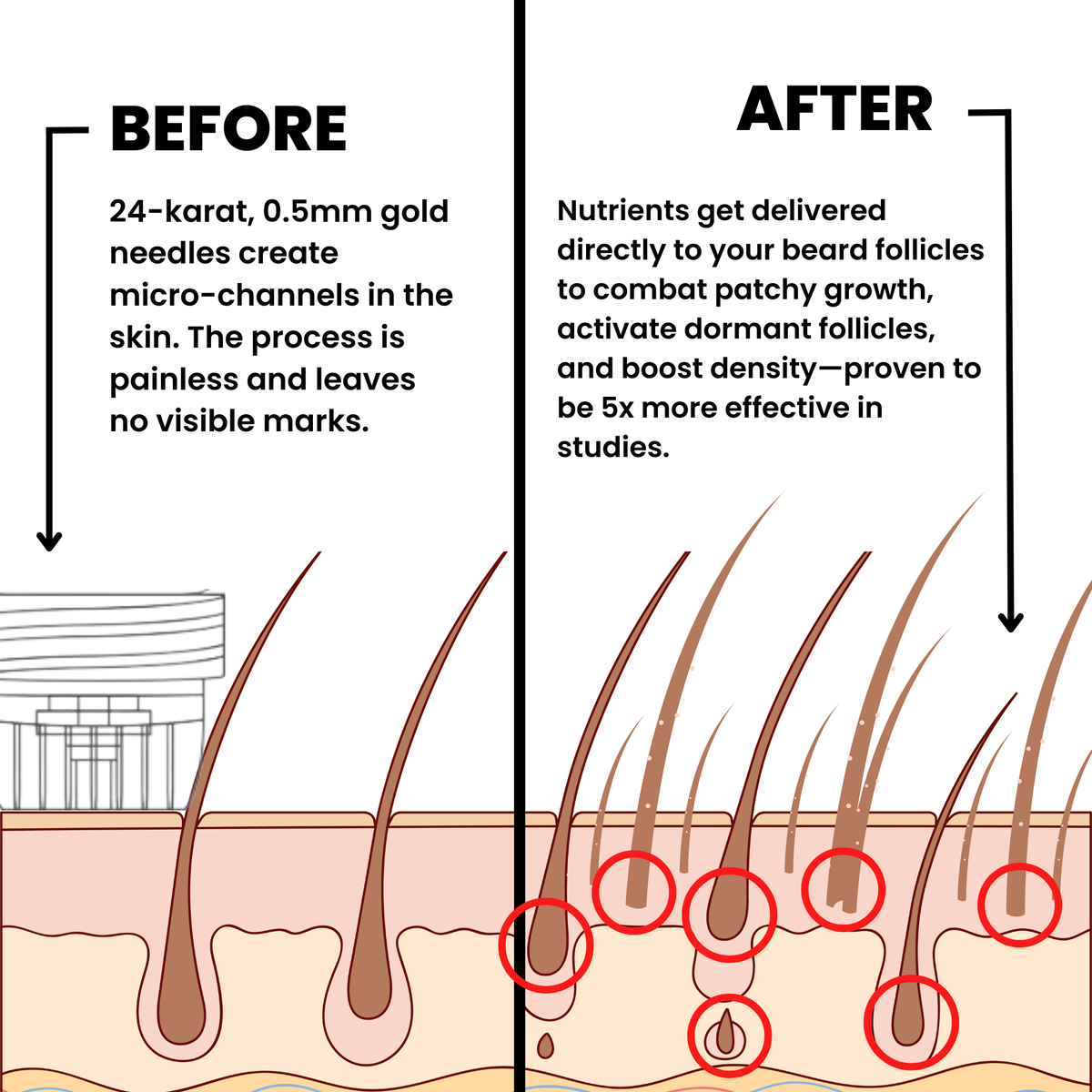 Alphainfuse™ Beard Growth System